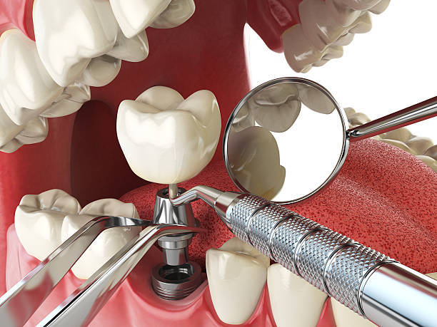 Best Emergency Treatment for Oral Infections in Taft, FL